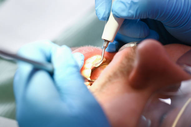 Best Pediatric Emergency Dentist in Emma, NC